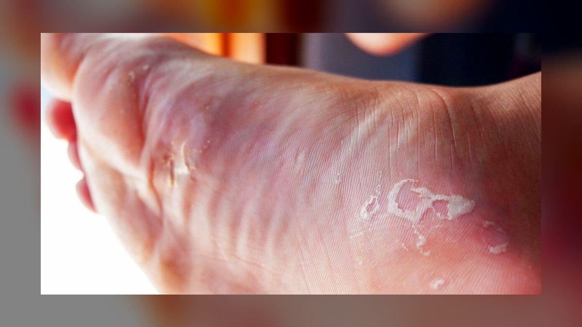 Top 10 fungal infection signs 2027 — figure 10