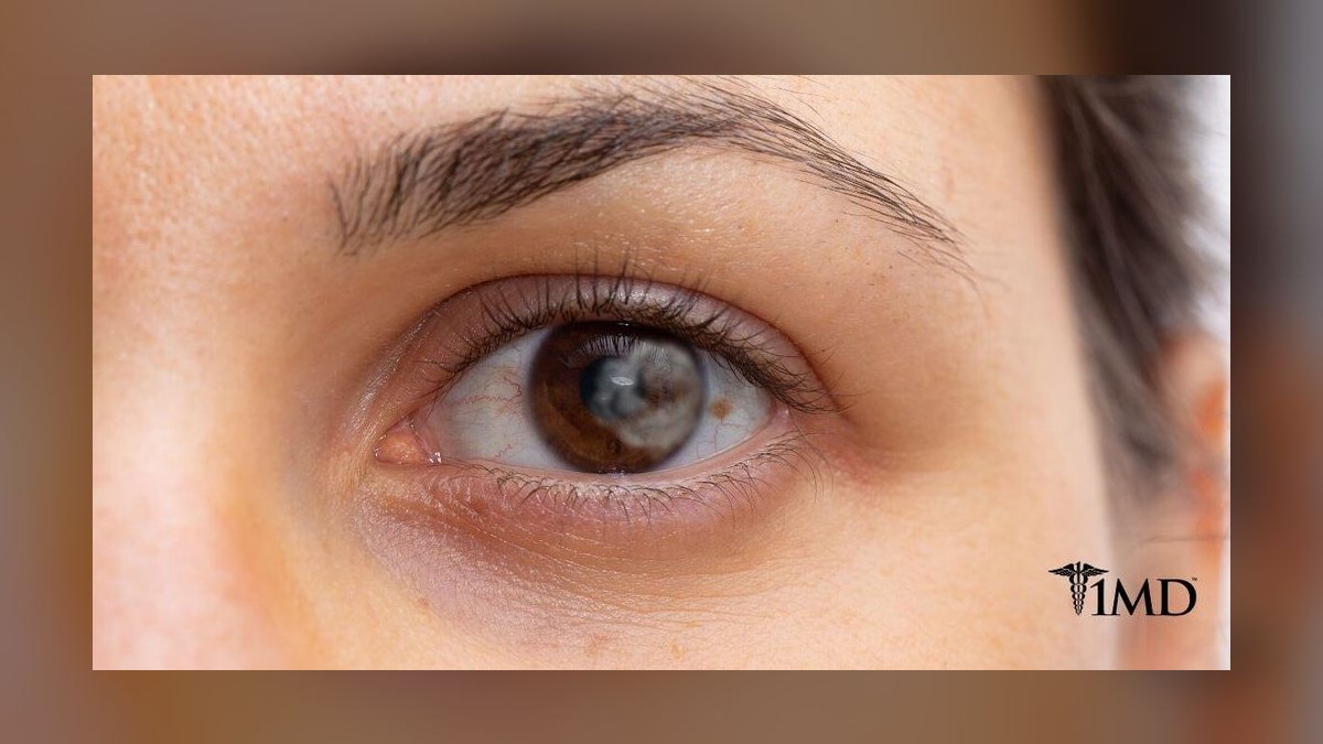 Top 10 fungal infection signs 2027 — figure 4