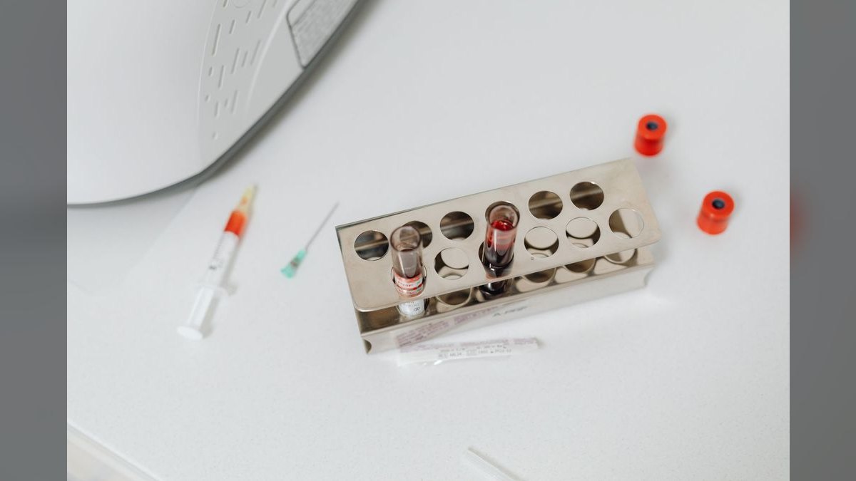 Top 10 Aquarium Test Kits for Water Parameters — figure 1