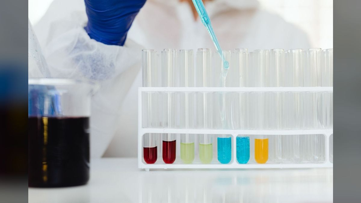 Top 10 Aquarium Test Kits for Water Parameters — figure 2