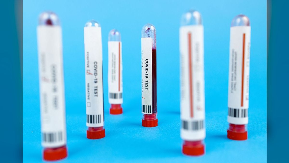 Top 10 Aquarium Test Kits for Water Parameters — figure 3
