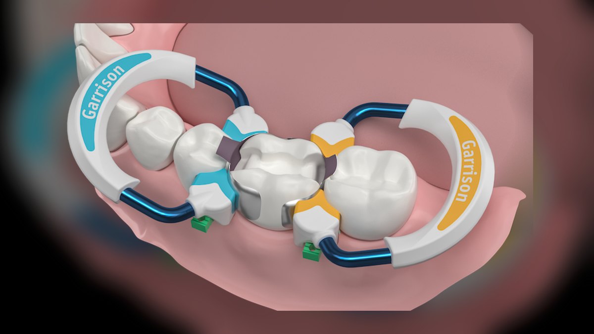 Top 10 Ceramic Media for Biological Filtration in 2027 — figure 6