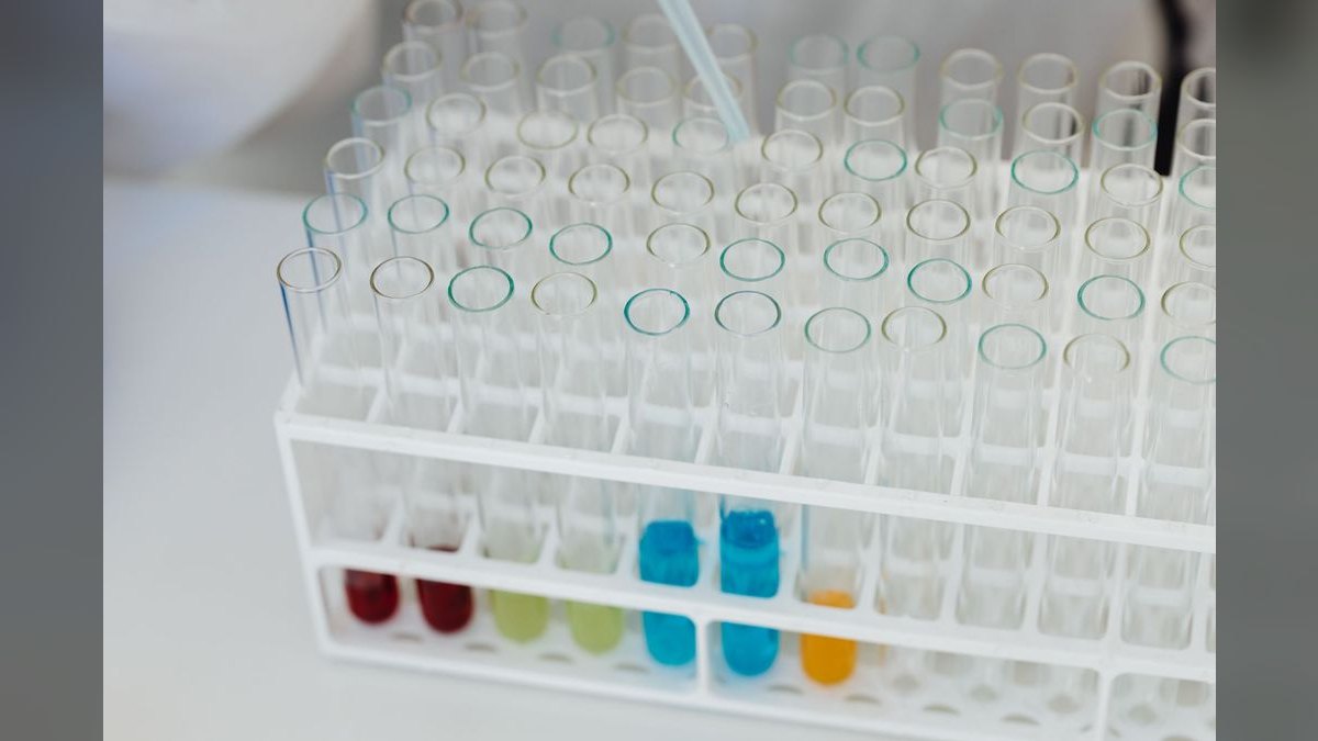 Top 10 Aquarium Test Kits for Accurate Ammonia, Nitrite, and Nitrate in 2027