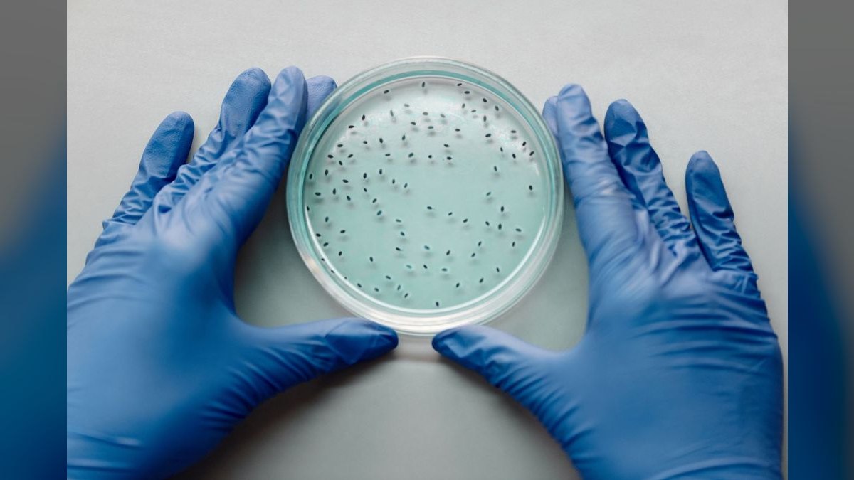 Top 10 Aquarium Bacteria Starters for Cycle Acceleration — figure 1