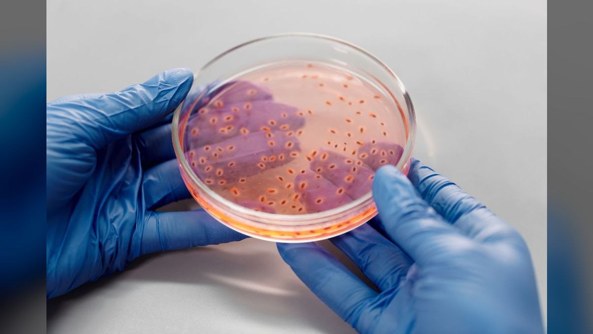 Top 10 Aquarium Bacteria Starters for Cycle Acceleration — figure 2