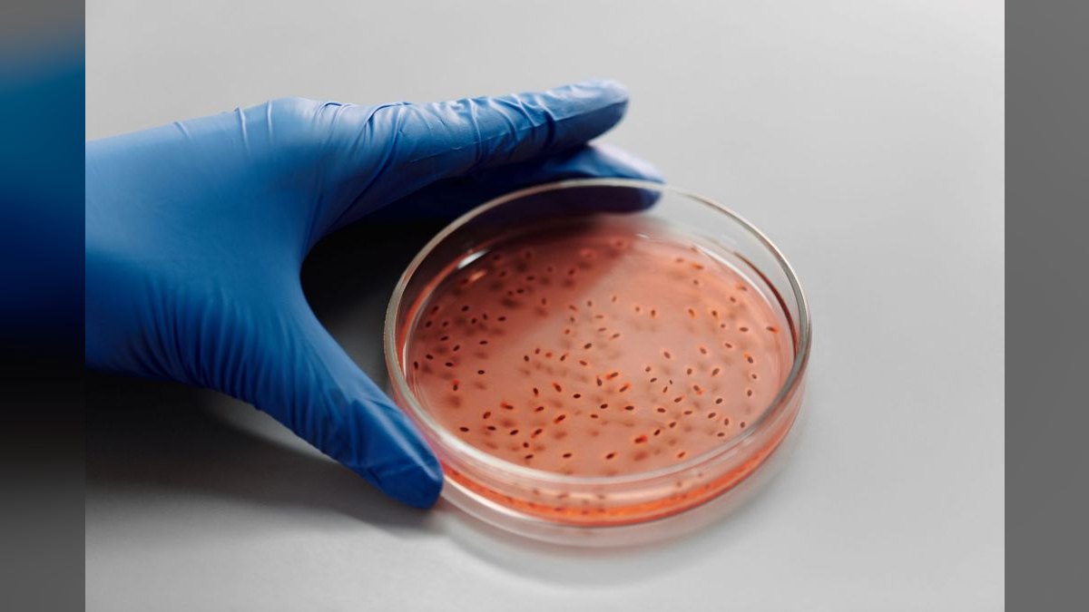 Top 10 Aquarium Bacteria Starters for Cycle Acceleration — figure 3