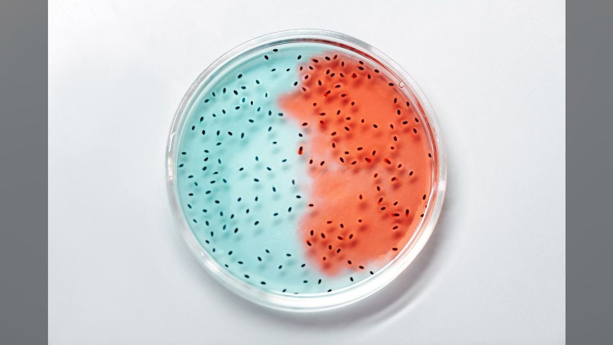 Top 10 Aquarium Bacteria Starters for Cycle Acceleration — figure 4