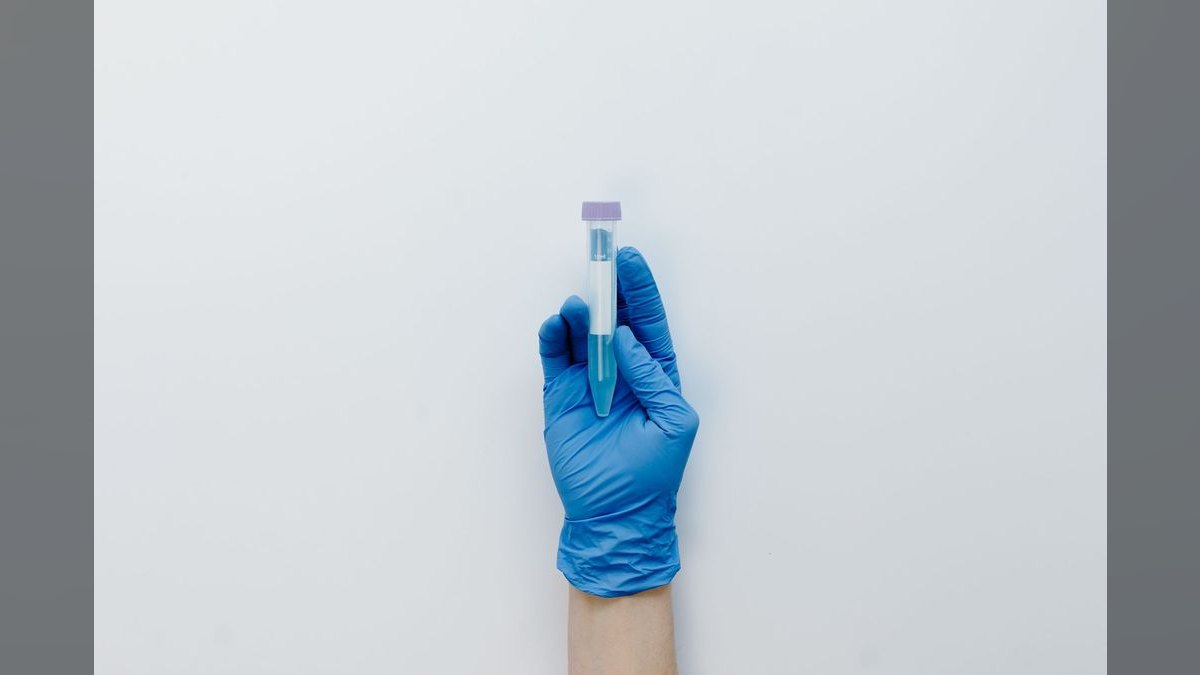 Top 10 Aquarium Test Kits for Monitoring Water Parameters — figure 2