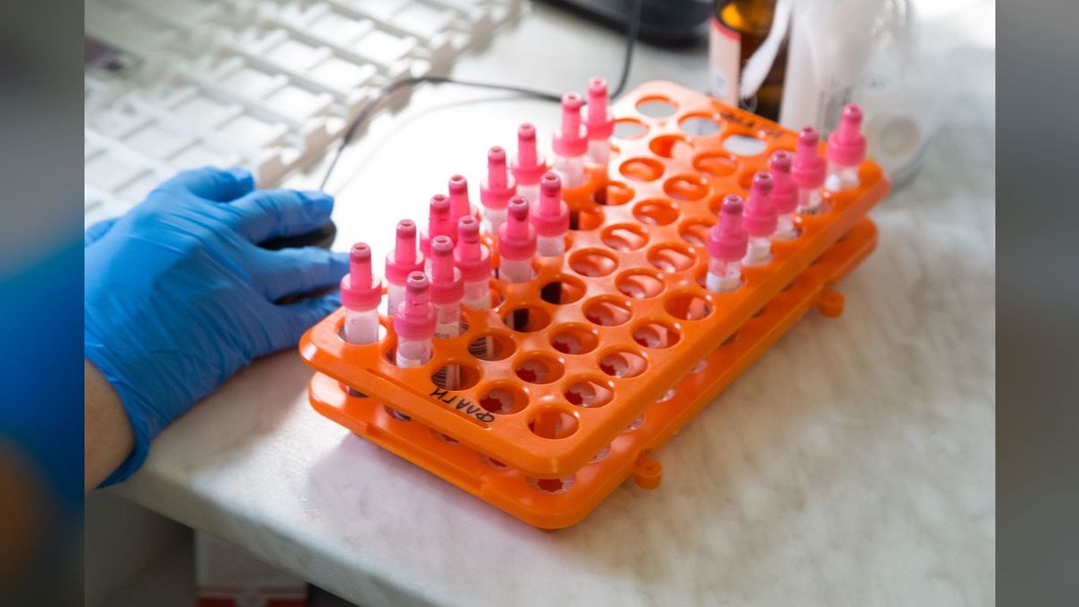 Top 10 Aquarium Test Kits for Monitoring Water Parameters — figure 5