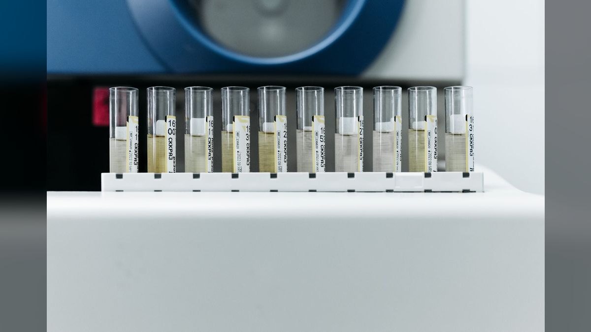 Top 10 Aquarium Test Kits for Monitoring Water Parameters — figure 6