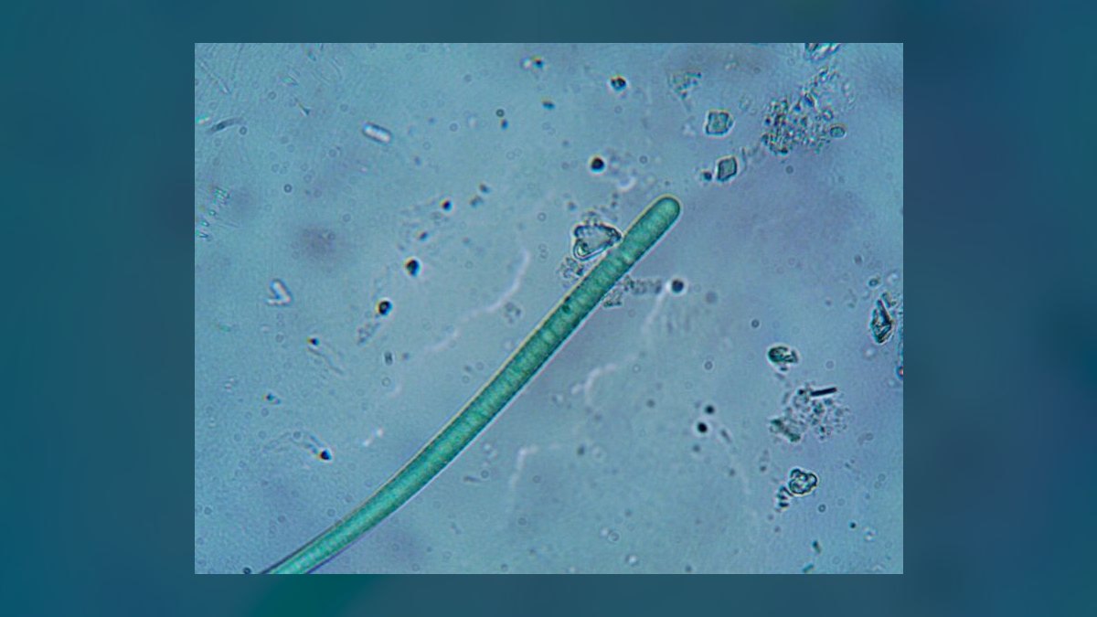 What is the best way to control cyanobacteria without using chemicals — figure 7