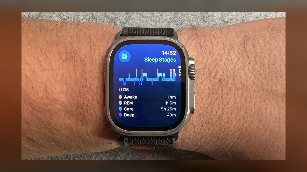 Top 10 Sleep Trackers — Best Overall + Best Value in 2027 — figure 3