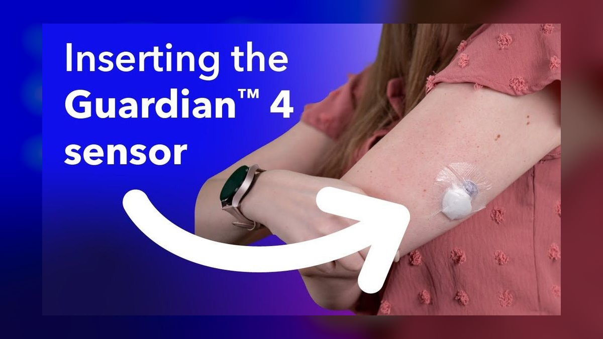 Top 10 Continuous Glucose Monitors — Best Overall + Best Value in 2027 — figure 3