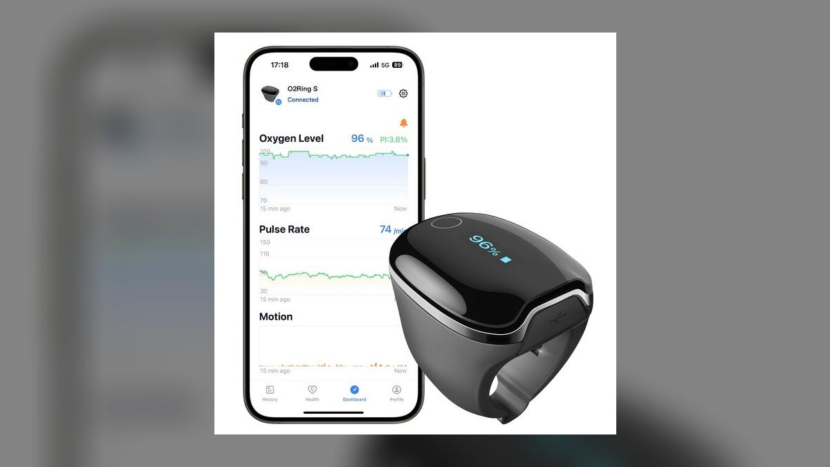 Top 10 Pulse Oximeters — Best Overall + Best Value in 2027 — figure 5