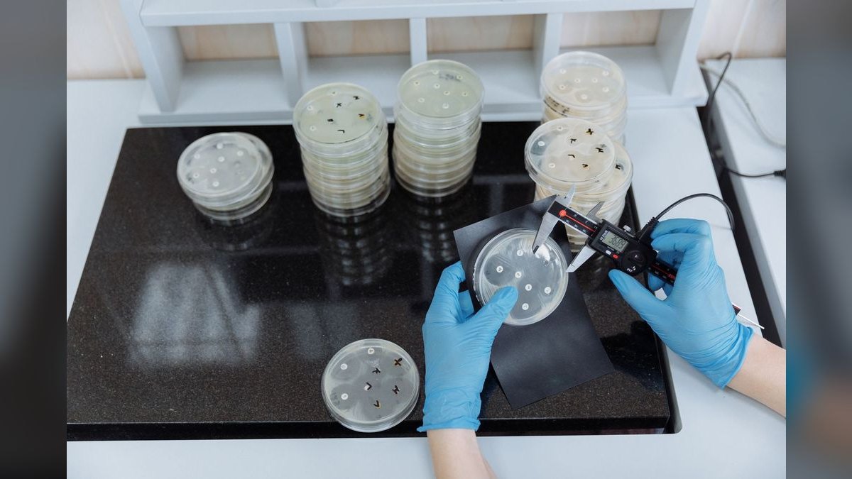Top 10 beneficial bacteria starters 2027 — figure 2