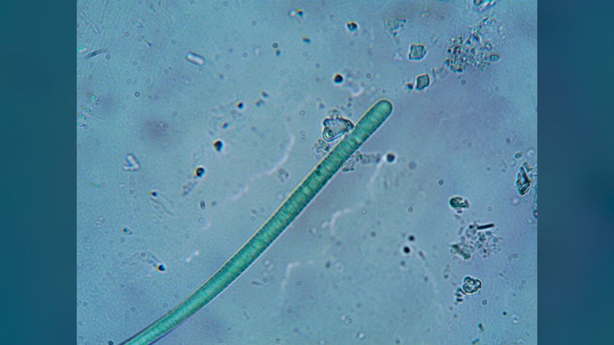 Top 10 beneficial bacteria starters 2027 — figure 5