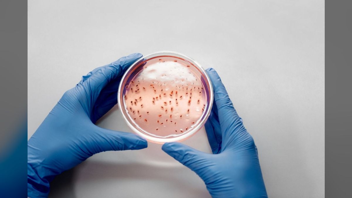 Top 10 beneficial bacteria starters 2027 — figure 6