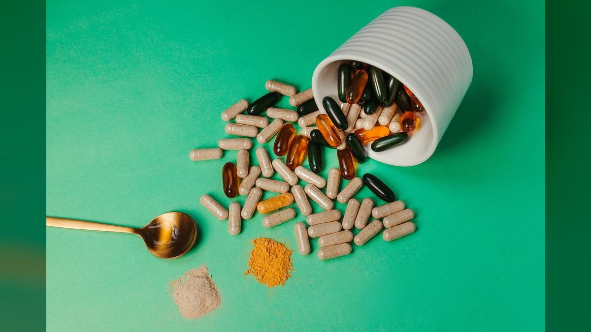 Top 10 Joint Support Supplements 2027 — figure 4