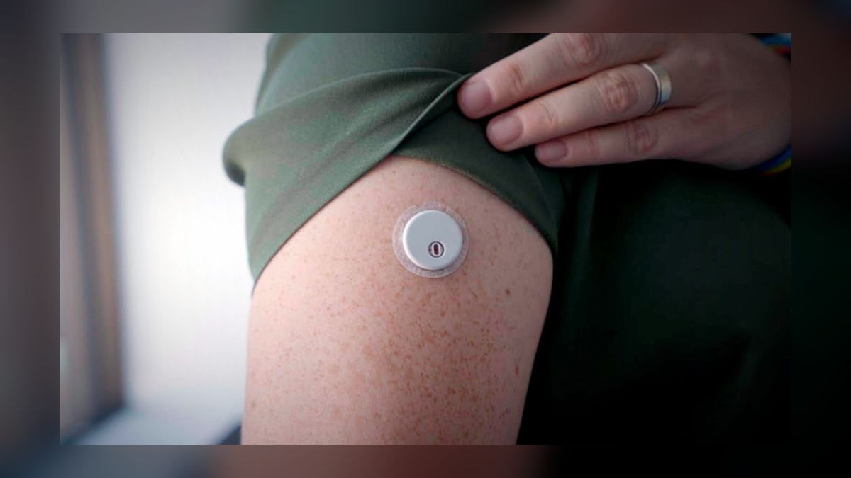 Top 10 Continuous Glucose Monitors 2027 — figure 10