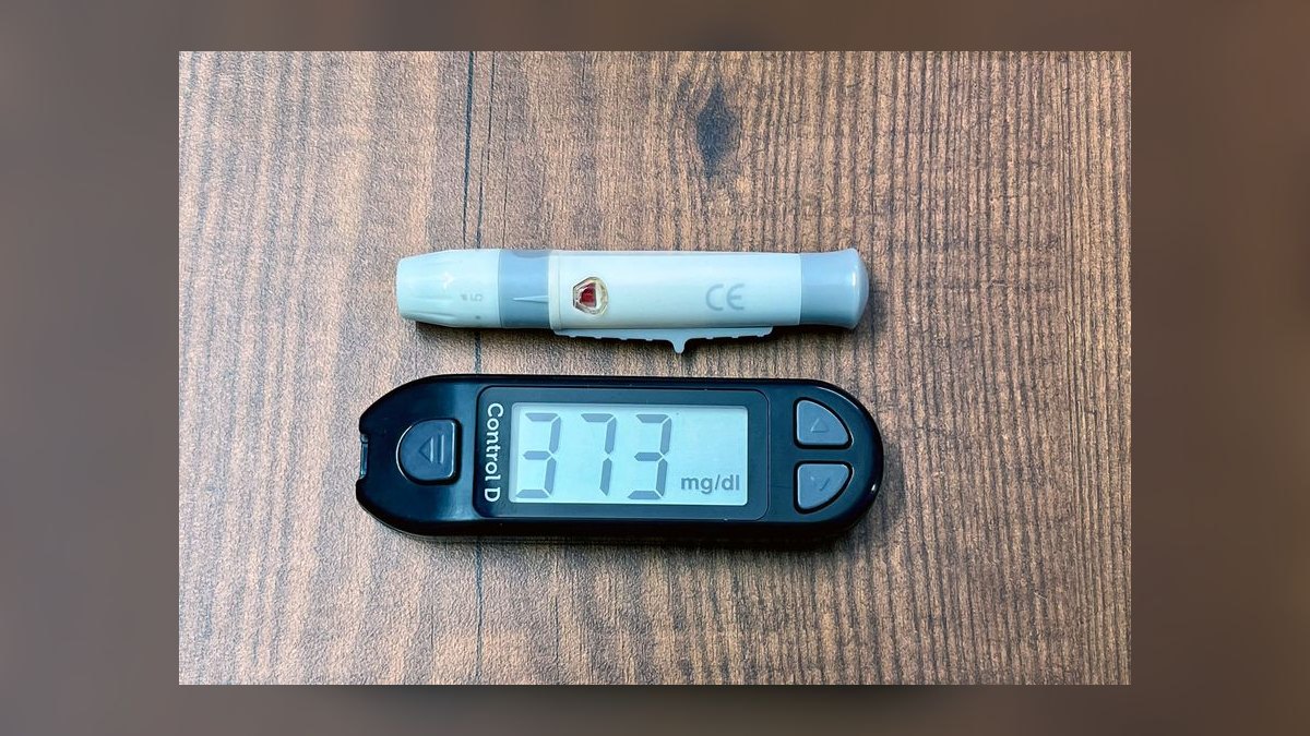 Top 10 Continuous Glucose Monitors 2027 — figure 3