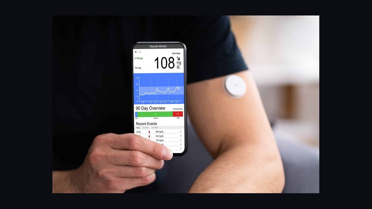 Top 10 Continuous Glucose Monitors 2027