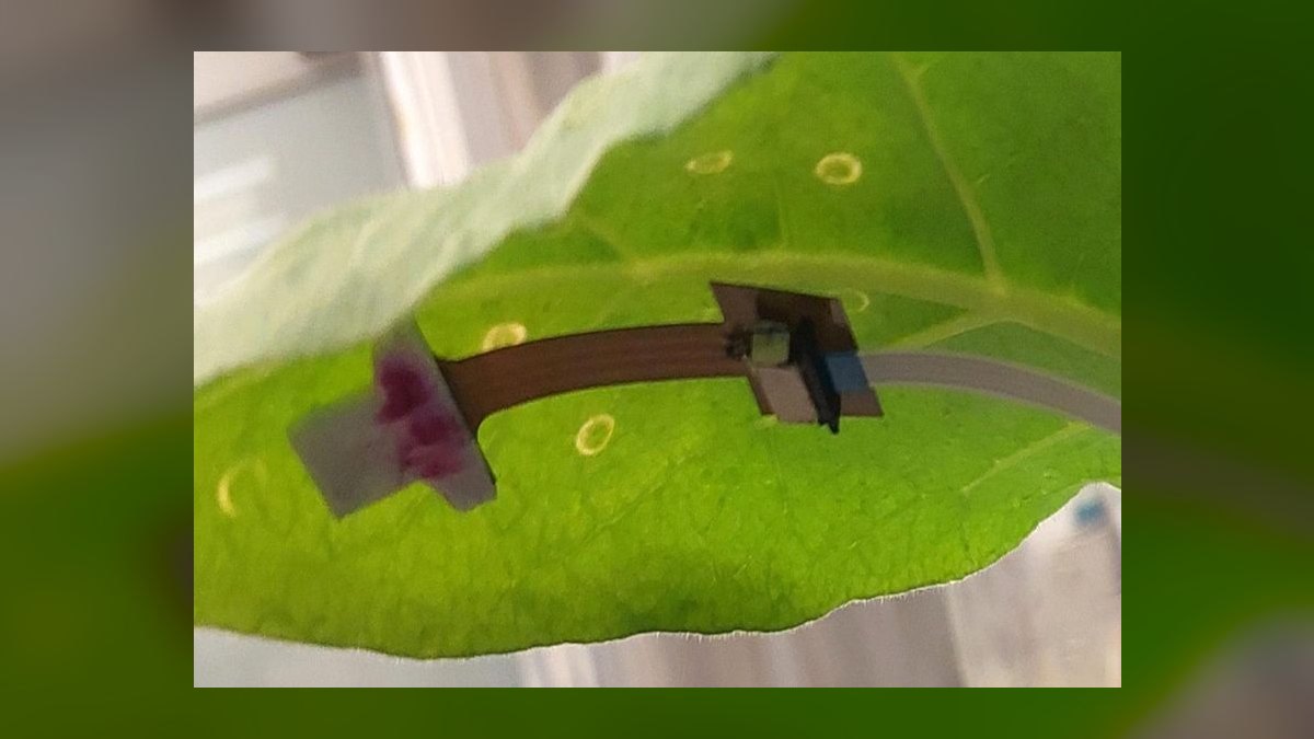 Top 10 Wearable Stress Sensors in 2027 — figure 9